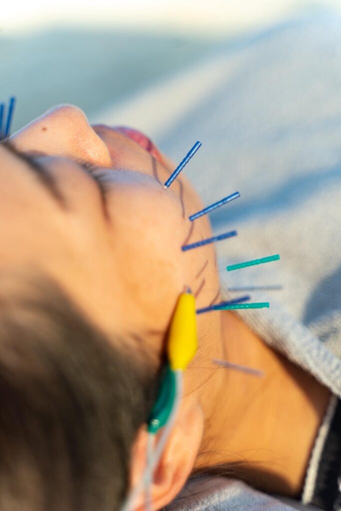 美容鍼灸サロン リュヌ メディア (3)